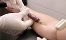 Что означает анализ крови на посев thumbnail