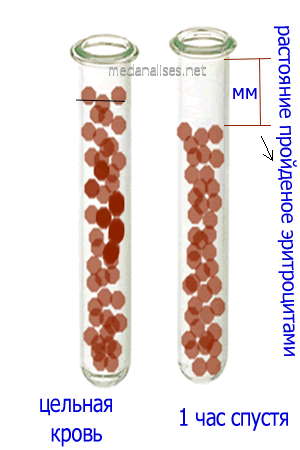 Скорость оседания эритроцитов метод