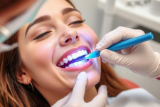Чистка зубов у стоматолога: зачем идти, чего ждать и как пережить без страха