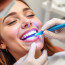 Чистка зубов у стоматолога: зачем идти, чего ждать и как пережить без страха