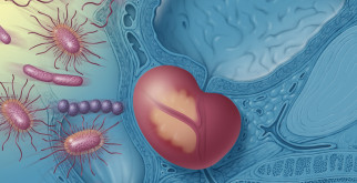 Однорогая матка: что это значит и как это влияет на жизнь женщины?