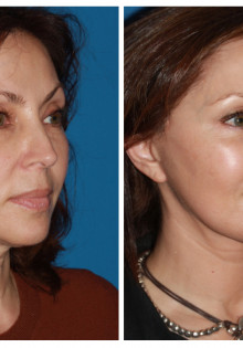 Что делать, если во влагалище сухо: причины и решения