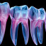 Важность рентген снимков зубов для здоровья вашей улыбки