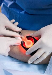 Что такое спленомегалия: все о увеличении селезенки у взрослых