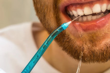 Нужен ли ирригатор, если вы регулярно посещаете стоматолога