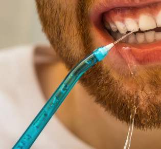 Нужен ли ирригатор, если вы регулярно посещаете стоматолога