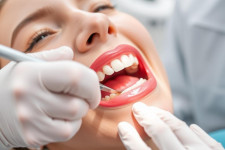 Как проходит лечение пульпита: этапы, методы и сохранение зуба без боли