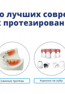 ВСЕ О ПРОТЕЗИРОВАНИИ ЗУБОВ