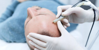 Особенности и преимущества удаления родинок сургитроном