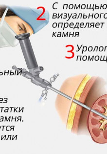 Трионикс: Загадочная черепаха с уникальной историей