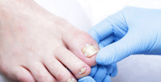 Спрут: что это такое и почему он привлекает внимание?