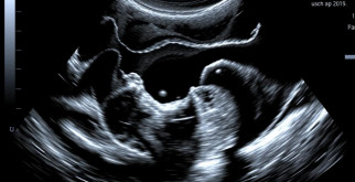 УЗИ мягких тканей: когда нужно и как проходит