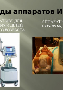 Аппараты ИВЛ: виды и характеристики