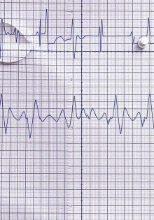 Все, что нужно знать об ЭКГ: просто и понятно о сложном