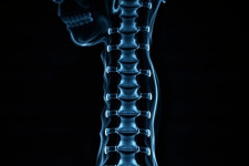 МРТ позвоночника: что это такое, зачем нужно и как к нему подготовиться
