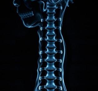 МРТ позвоночника: что это такое, зачем нужно и как к нему подготовиться