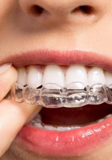 Что такое лейкоплакия шейки матки и почему это важно знать?