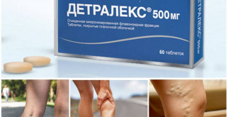 Что такое острый вагинит: симптомы, причины и лечение