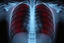 Рентген без страха: как он работает, зачем нужен и как себя вести