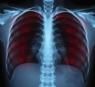 Рентген без страха: как он работает, зачем нужен и как себя вести