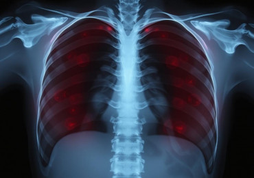 Рентген без страха: как он работает, зачем нужен и как себя вести