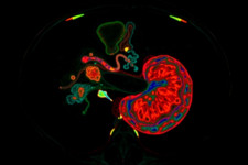 МРТ поджелудочной железы: как проходит исследование и что оно показывает