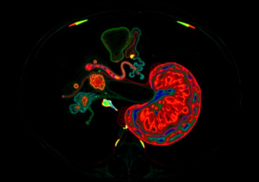 МРТ поджелудочной железы: как проходит исследование и что оно показывает