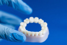 Протезирование зубов: как вернуть улыбку и привычный ритм жизни