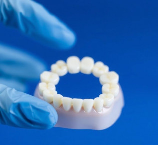 Протезирование зубов: как вернуть улыбку и привычный ритм жизни