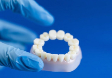 Протезирование зубов: как вернуть улыбку и привычный ритм жизни