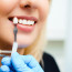 Реставрация зубов: как выбрать лучшую клинику и метод лечения