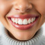 Ретейнеры для выравнивания зубов: что это такое и почему они так важны