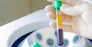 ЧТО ТАКОЕ PRP-ТЕРАПИЯ?