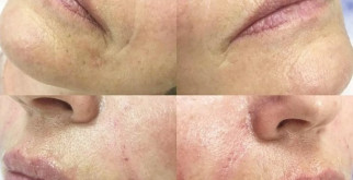 Бокошейная черепаха: Защитник воды и земли в нашем мире