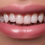 Лечение зубов: как сделать процесс максимально комфортным