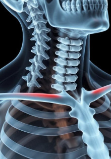 Как восстановиться после перелома ключицы: практическое руководство