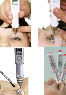 Тонометры офтальмологические: важное оборудование для контроля глазного давления