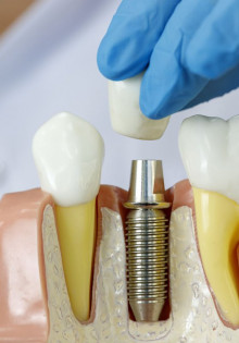 Ретродевиация матки: что это такое и как с этим жить