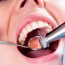 Как лечат запущенные зубы?