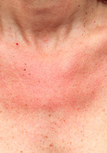 Горлинка: обаятельная маленькая птица с большими секретами