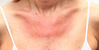 Горлинка: обаятельная маленькая птица с большими секретами