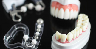 Ортодонтические аппараты: что это, зачем нужны и как выбрать подходящий