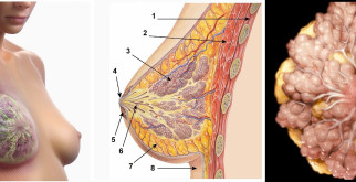 Популярный миф про рак молочной железы: что нужно знать об этой опасной болезни