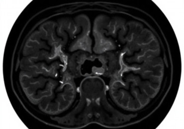 МСКТ ангиография брюшной аорты и артерий нижних конечностей в медицинском центре