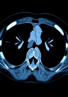 Компьютерная томография: погружение в мир трехмерных изображений
