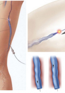 КРЖ шейки матки: что это такое и почему важно знать о здоровье