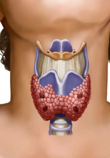 Какова связь между заболеванием щитовидной железы и COVID-19? Вот ответы на 7 ключевых вопросов