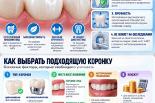 Стоматология в Китае: выбираем зубные коронки Upcera (爱尔创)