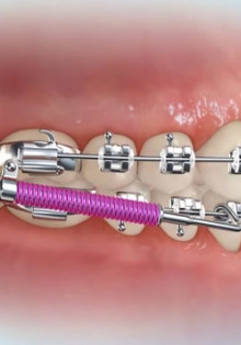 Вамбат: Уникальный обитатель австралийских просторов