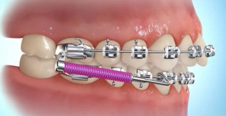 Вамбат: Уникальный обитатель австралийских просторов